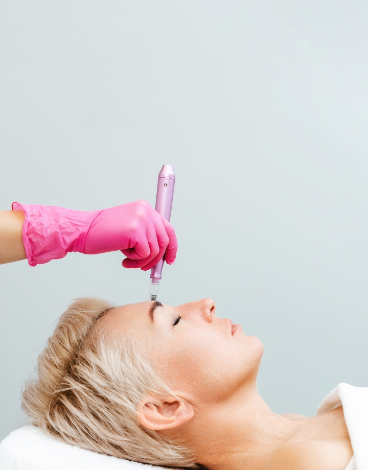Microagulhamento Facial